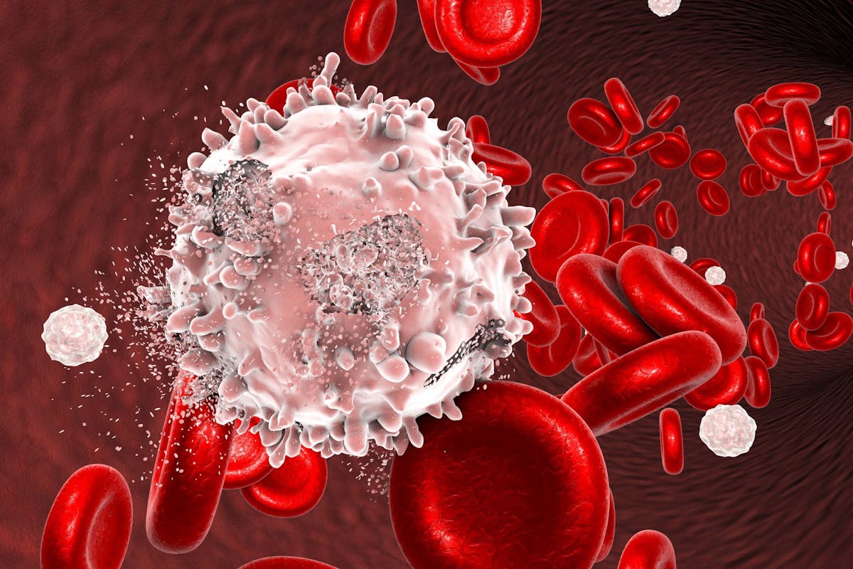 Data science for better treatment of leukemia